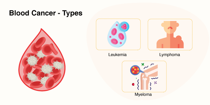 Blood cancer - Types