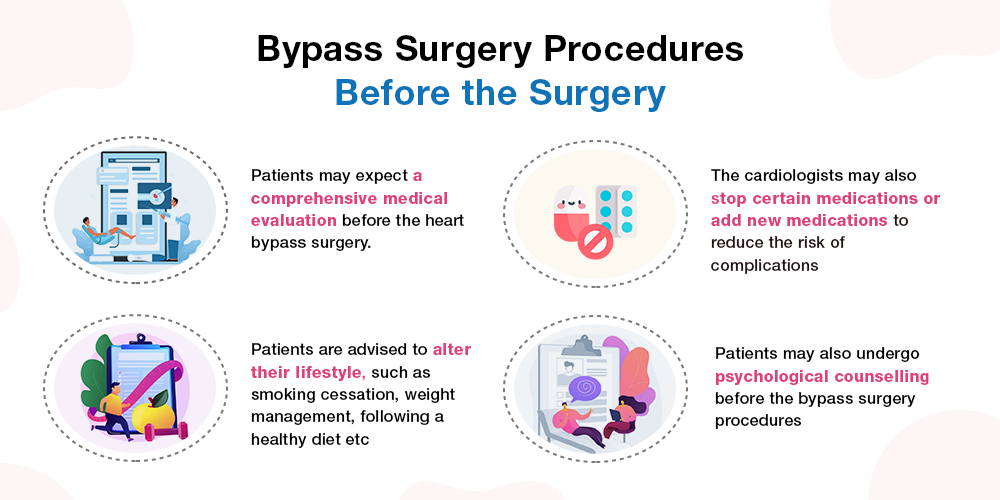 Bypass Surgery Procedures - Before the Surgery