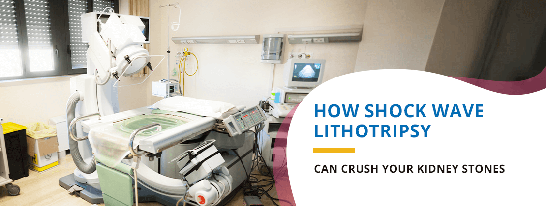 How Shock Wave Lithotripsy Can Crush Your Kidney Stones