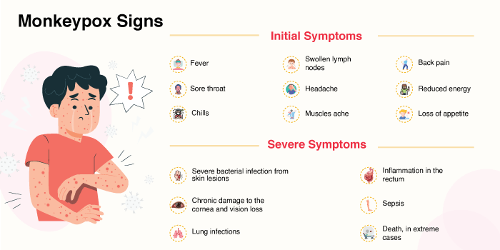 Monkeypox symptoms