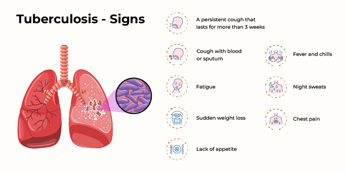 Tuberculosis - Signs