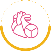 Defibrillator Implantation