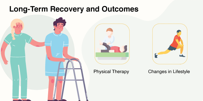 Knee Replacement Surgery - Long-term recovery and outcomes