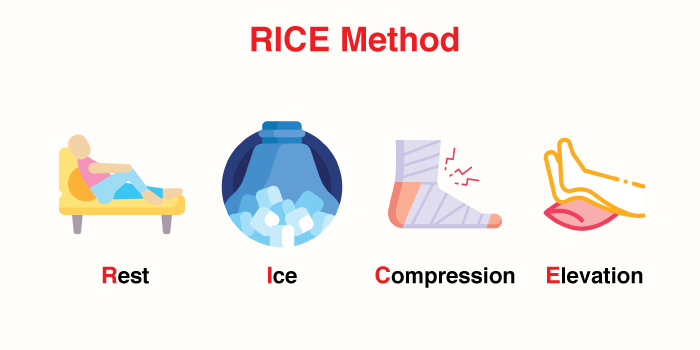 Arthritis: RICE Method