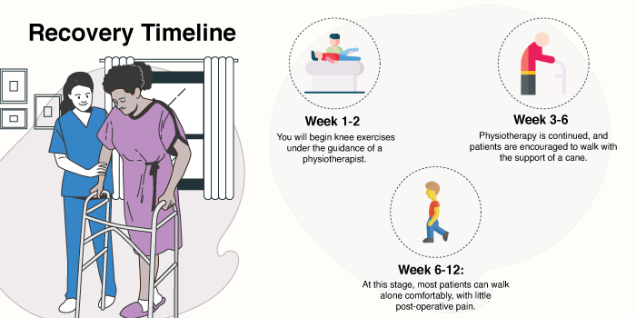 Knee Replacement Surgery - Recovery Timeline