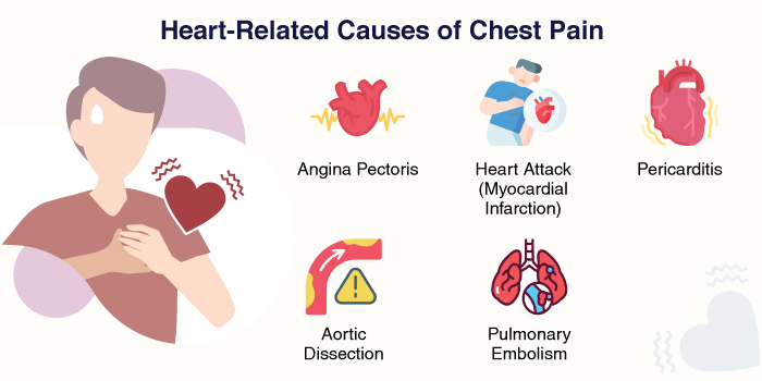 Heart-Related Causes of Chest Pain