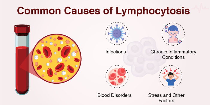 Common Causes of Lymphocytosis