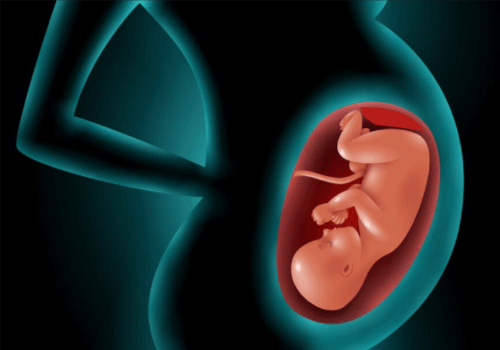 What is Placental Abruption